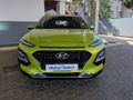2021 Hyundai Kona 1.0 TGDI Executive