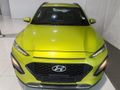 2021 Hyundai Kona 1.0 TGDI Executive