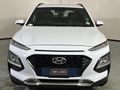 2021 Hyundai Kona 1.0 TGDI Executive