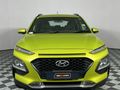 2018 Hyundai Kona 2.0 Executive Auto